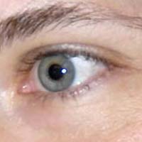 Ricerca: occhi marroni diventano azzurri grazie al laser