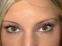 Dal ‘Washington Post’ l’allerta botox