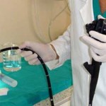 20100327_colonscopio_intestino