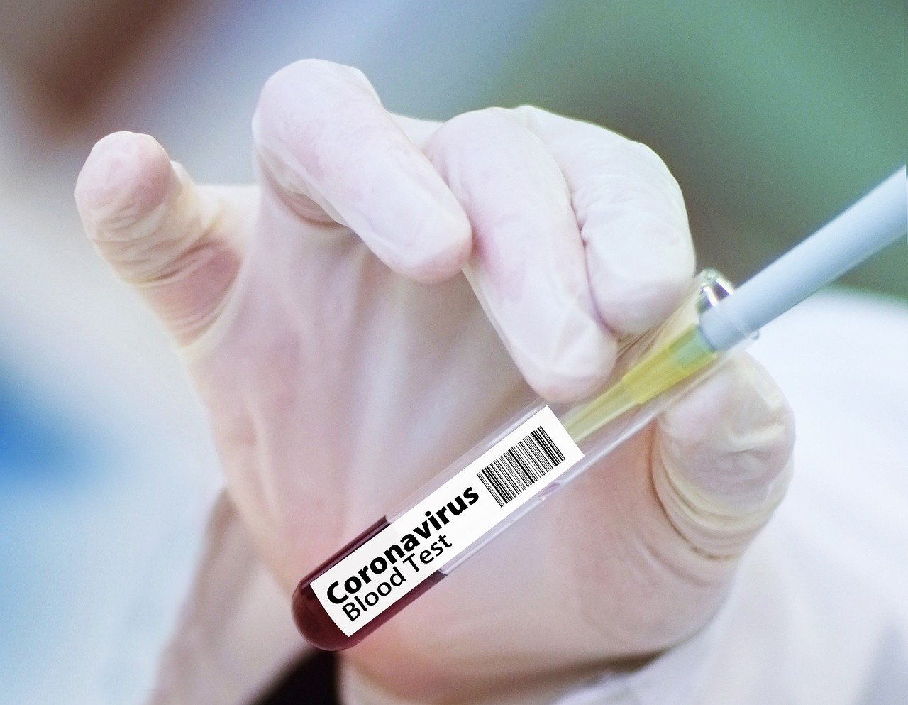 Coronavirus, in Toscana 38 nuovi casi, 12 di rientri dall’estero