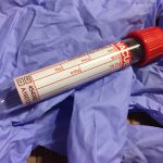 coronavirus covid