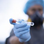 covid-19-coronavirus-laboratorio-infermiere-positivo